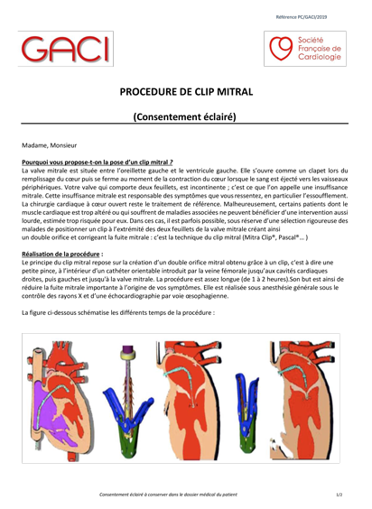 SFC - GACI : Procédure Clip Mitral