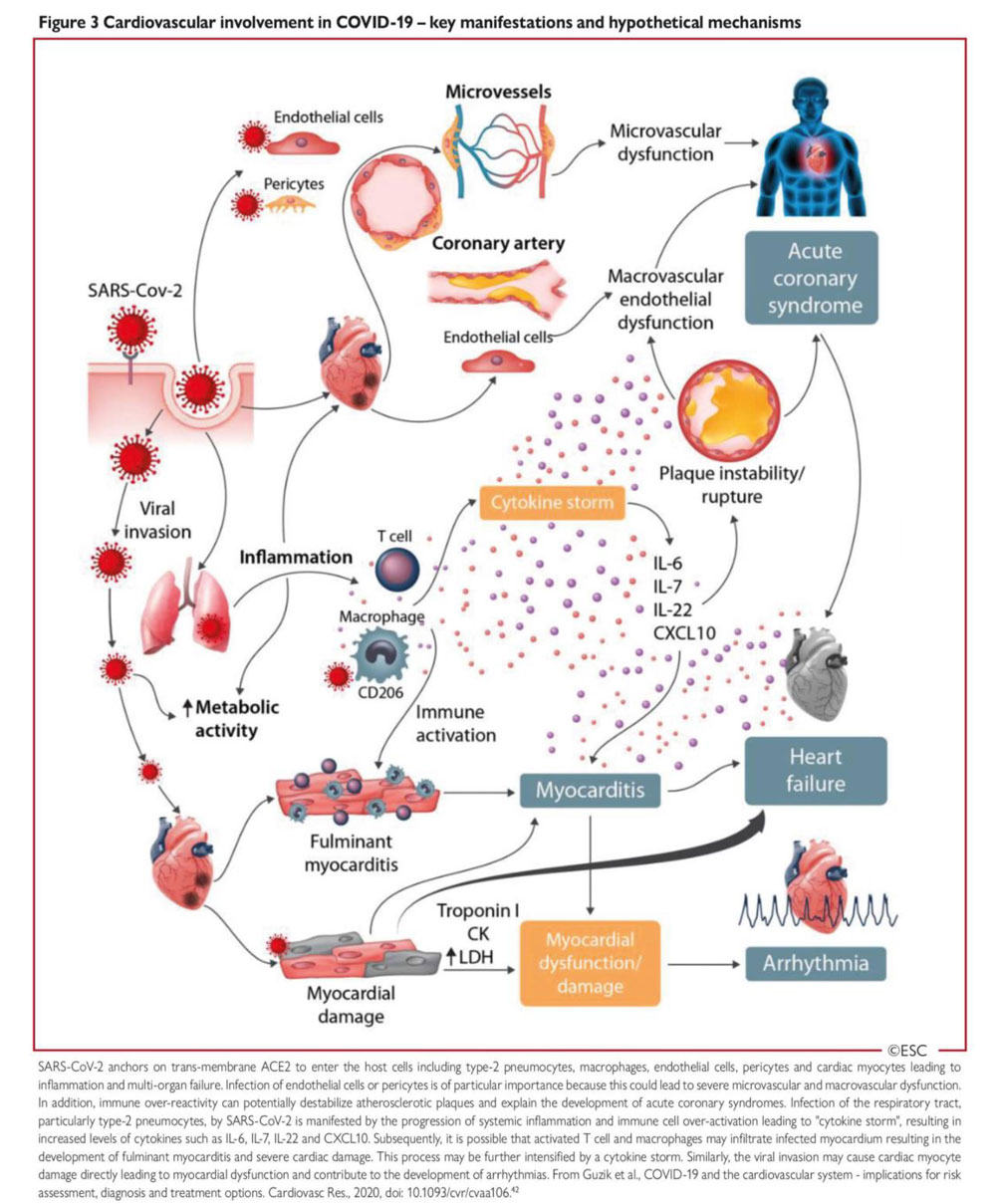 Figure 3 – Répercussions du SARS-Cov-2 sur le système cardiovasculaire : manifestations principales et hypothèses d’action