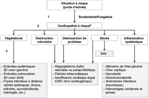 resume de la sequence du mecanisme general responsable de l’apparition d’une endocardite infectieuse et de ses complications