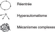 mecanisme des arythmies