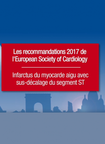 SFC - Infarctus du myocarde aigu avec sus-déclage du segment ST - recommandations ESC 2017